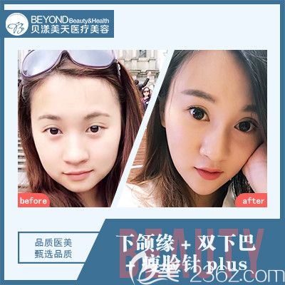 深圳貝漾美天孫音醫(yī)生<span style=