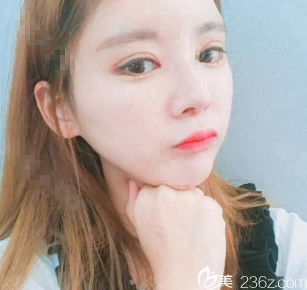 韓國佳輪韓整形醫(yī)院做輪廓怎么樣 韓國佳輪韓整形醫(yī)院做輪廓怎么樣