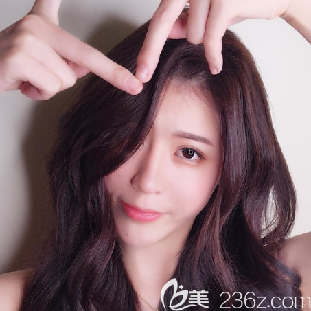 廣州中家醫(yī)家庭醫(yī)院朱云做雙眼皮隆鼻怎么樣 廣州中家醫(yī)家庭醫(yī)院朱云做雙眼皮隆鼻怎么樣