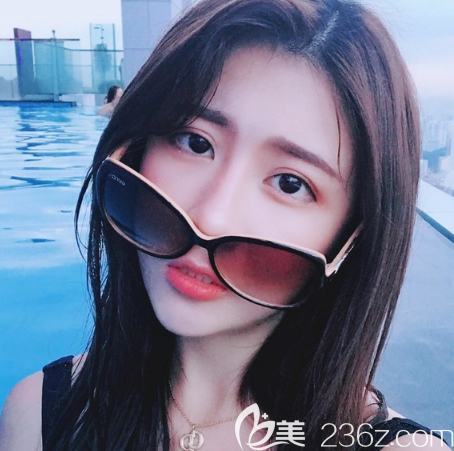 找廣州中家醫(yī)家庭醫(yī)院朱云做的雙眼皮隆鼻<span style= 找廣州中家醫(yī)家庭醫(yī)院朱云做的雙眼皮隆鼻<span style=