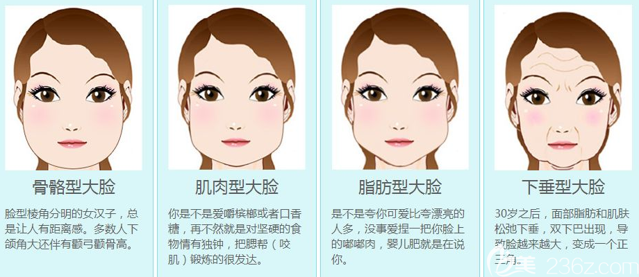 面部輪廓整形醫(yī)生金洞河講大臉的分類 面部輪廓整形醫(yī)生金洞河講大臉的分類