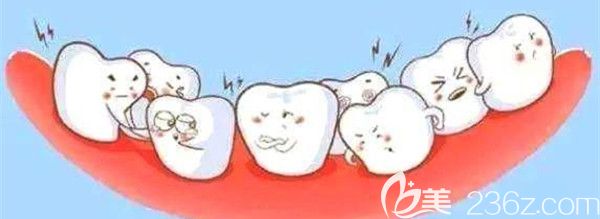 錯(cuò)過黃金矯正器，成年人矯正不限制年齡