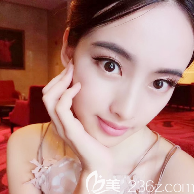 <!--<i data=20240703-sp></i>-->醫(yī)院<!--<i data=20240703-sp></i>-->做的全臉自體脂肪填充案例 <!--<i data=20240703-sp></i>-->醫(yī)院<!--<i data=20240703-sp></i>-->做的全臉自體脂肪填充案例