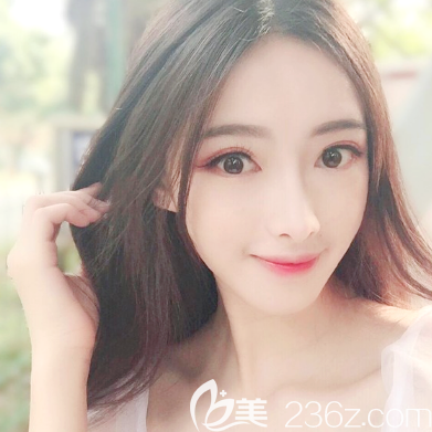 <!--<i data=20240703-sp></i>-->醫(yī)院面部脂肪填充術后一個月 <!--<i data=20240703-sp></i>-->醫(yī)院面部脂肪填充術后一個月