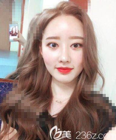 韓國首爾麗絲塔整形隆鼻案例