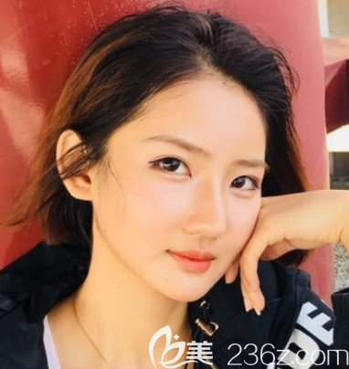 做過拉皮手術(shù)后悔要死,看我去韓國拉菲安整形做自體脂肪面部填充+拉皮手術(shù)對比照片