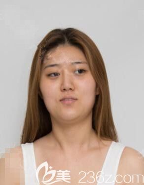 術(shù)前 術(shù)前