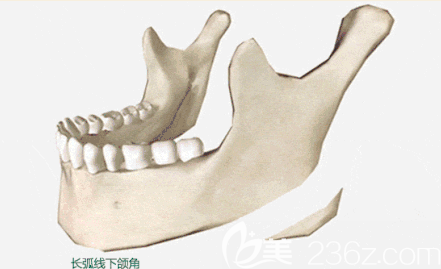 長曲線下頜角示意圖