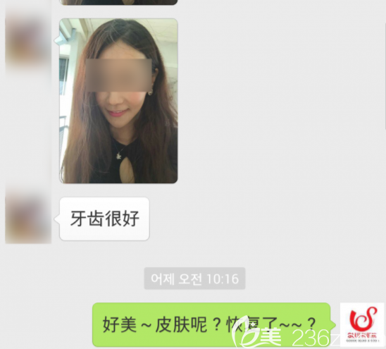 瓷貼面反饋 瓷貼面反饋