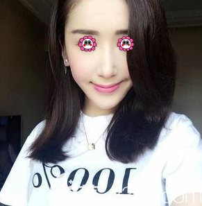 北京畫美做鼻修復(fù)第67天樣子 北京畫美做鼻修復(fù)第67天樣子