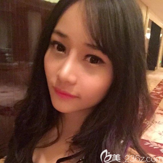 聽說韓國自然主義整形醫(yī)院做鼻子不錯(cuò)，預(yù)約做了雙眼皮+開內(nèi)眼角+鼻綜合隆鼻手術(shù)