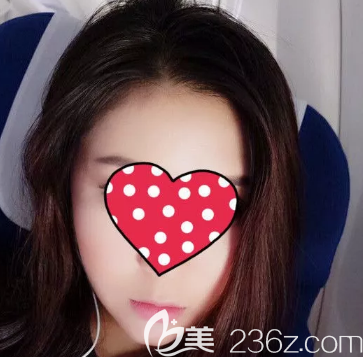 開心在德州做了面部吸脂手術(shù)，當(dāng)時(shí)打腫脹液的時(shí)候真的是痛很，但是為了美我忍了