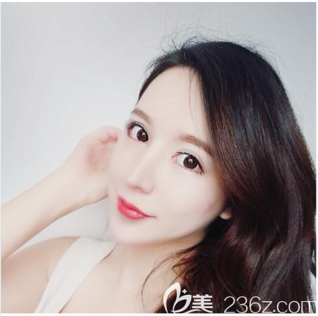 公開我去廣州藝美找張濤做雙眼皮失敗修復找李闖做鼻綜合隆鼻修復的親身經(jīng)歷