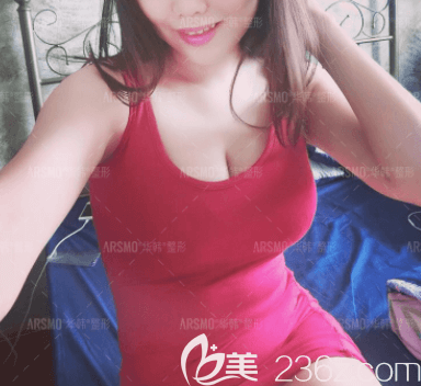 北京華韓曼托假體隆胸