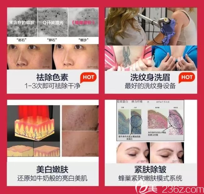 蜂巢皮秒鐳射主要治療臉上各種斑點 蜂巢皮秒鐳射主要治療臉上各種斑點