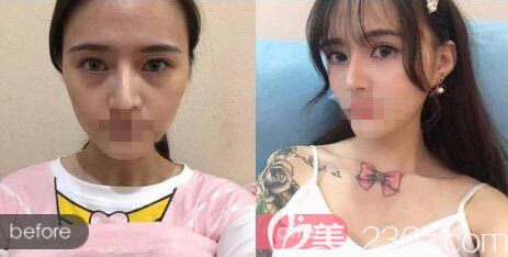 洛陽華美田會建美容護膚前后對比案例