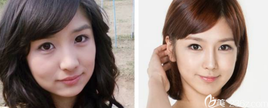 韓國高蘭得輪廓 韓國高蘭得輪廓