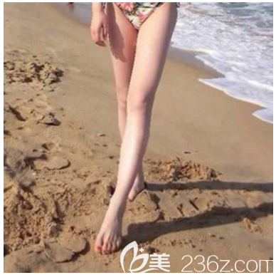 公開(kāi)我去深圳美加美整形醫(yī)院找陳群院長(zhǎng)做大腿吸脂的親身經(jīng)歷和感受