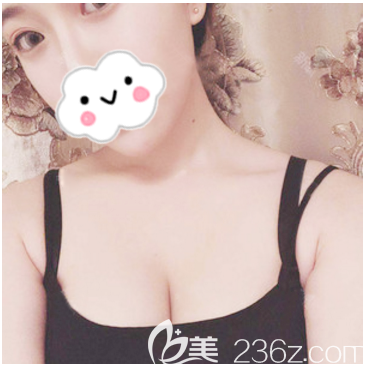 湛江隆胸哪家醫(yī)院好？公開我找湛美陳海濤醫(yī)生做的豐胸案例效果和整形價格表