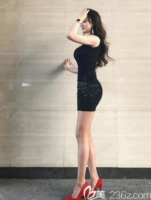 【韓國(guó)女神整形醫(yī)院:假體豐臀怎么樣 【韓國(guó)女神整形醫(yī)院:假體豐臀怎么樣