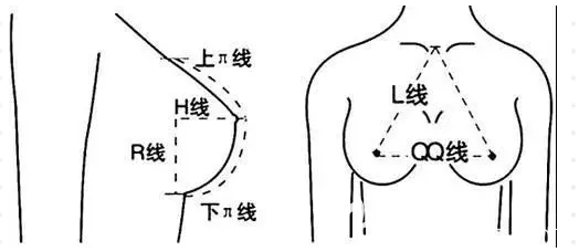 隆胸手術美學標準