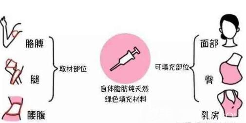 自體脂肪移植填充原理