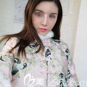 提前了解過自體脂肪填充成活率、恢復(fù)、風(fēng)險(xiǎn)等問題后 在徐州時(shí)光洪揚(yáng)做了全面部脂肪移植