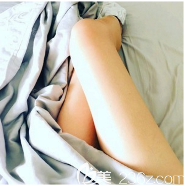 東莞華美詹慧院長做的大腿吸脂兩個月自拍