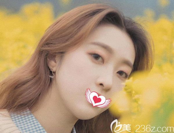 玻尿酸填充下巴20天成活率很高，摸著很柔軟