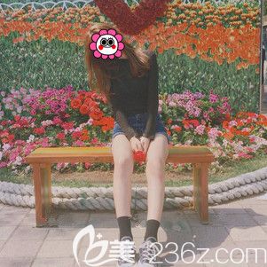 看過鄒志英分享的2019吸脂價格表 我選擇到常州美貝爾做了吸脂瘦大腿參與優(yōu)惠活動價格劃算