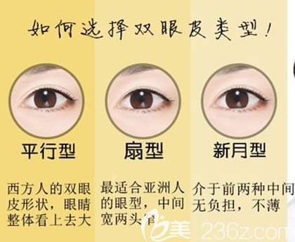 韓國MVP眼部整形類型