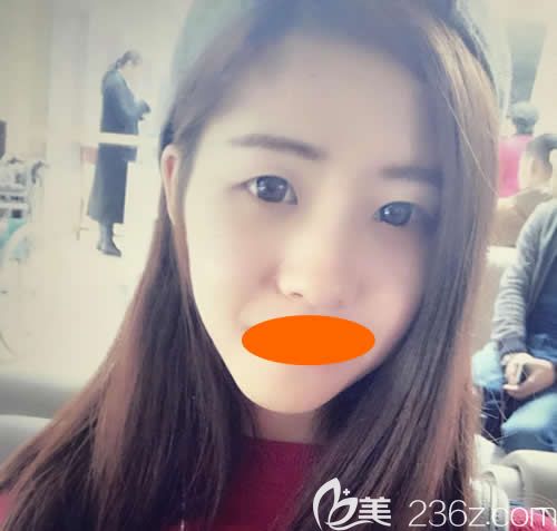 沒去贛州韓美整形割雙眼皮+隆鼻前的照片 沒去贛州韓美整形割雙眼皮+隆鼻前的照片