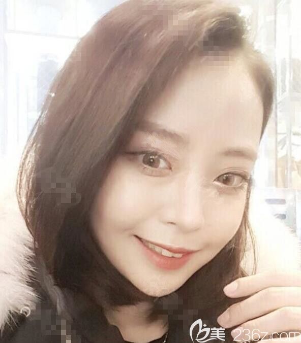 術(shù)后2周 術(shù)后2周