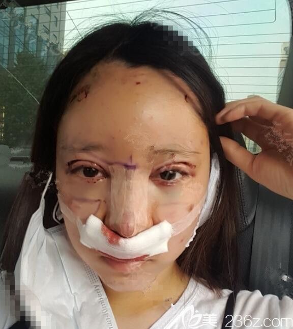 術(shù)后<span style= 術(shù)后<span style=