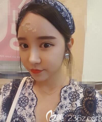 韓國德麗珍整形醫(yī)院那個(gè)院長做鼻子好 韓國德麗珍整形醫(yī)院那個(gè)院長做鼻子好