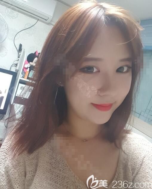 韓國德麗珍整形醫(yī)院眼鼻真人<span style= 韓國德麗珍整形醫(yī)院眼鼻真人<span style=