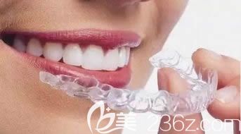 全隱形牙套正畸示意圖