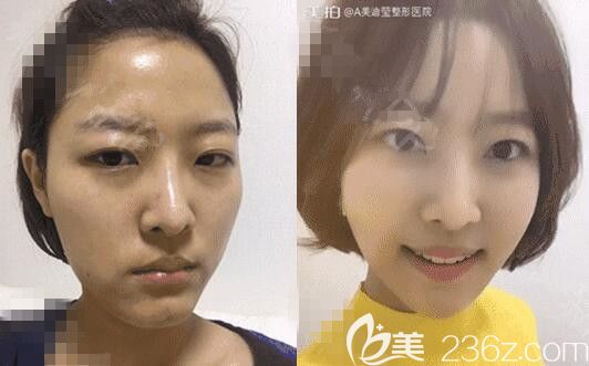 韓國美迪瑩徐范信輪廓怎么樣 韓國美迪瑩徐范信輪廓怎么樣