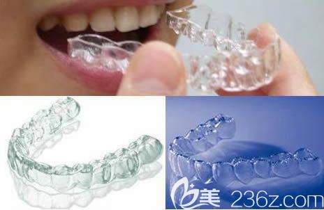 牙套的種類和價格請看湛江致美口腔正畸醫(yī)生<!--<i data=20240703-sp></i>-->宏解答