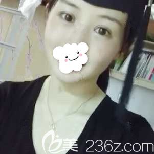 征募上徐州時(shí)光洪揚(yáng)的模特后挑戰(zhàn)了以全切雙眼皮為主的眼綜合加上自體脂肪面部填充 還拿到價(jià)格參考表