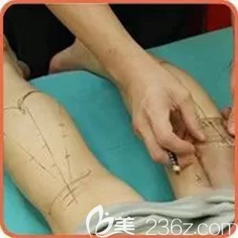 注射瘦腿前的設(shè)計過程 注射瘦腿前的設(shè)計過程