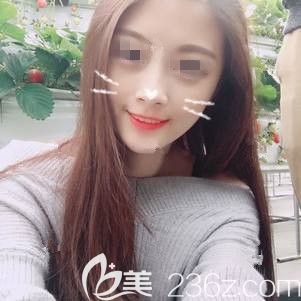 雖然快一萬的自體脂肪填充比線雕價格貴，但是選對常州美貝爾專業(yè)醫(yī)院術(shù)后沒有后遺癥成活率還高