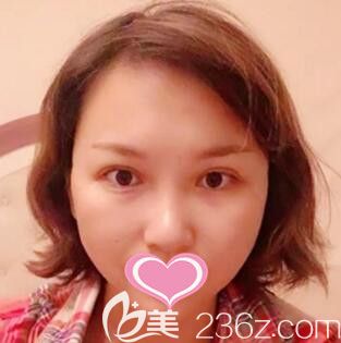 在長沙華韓華美做<span style=