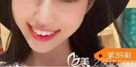 第21副和39副的變化圖 第21副和39副的變化圖