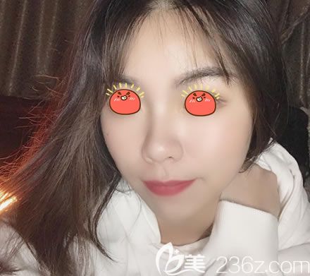 在紹興維美整形醫(yī)院做完皮秒激光祛斑后，我發(fā)現(xiàn)我解鎖了新形象,而且手術(shù)收費(fèi)不高