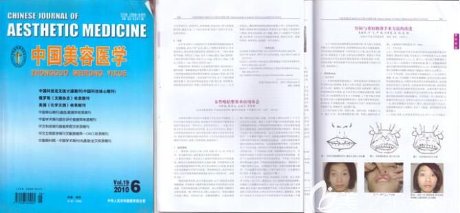 劉黃霞醫(yī)生發(fā)表的部分論文圖 劉黃霞醫(yī)生發(fā)表的部分論文圖