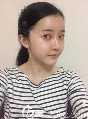 20190531_1559288246873884.jpg 術(shù)后14天_副本.jpg