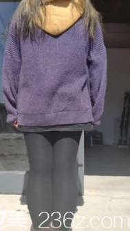 術(shù)前的我大腿狀況 術(shù)前的我大腿狀況