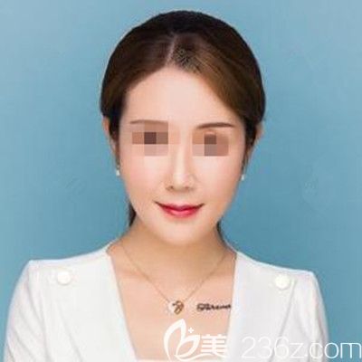 找韓國(guó)寶士麗李承浩做面部埋線提升+輪廓針3個(gè)月的效果我就很喜歡