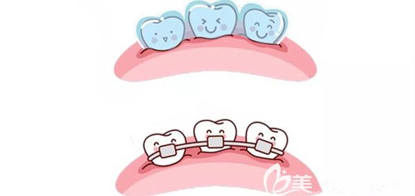 口腔正畸后的<span style=